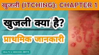 Khujli Kya Hai | Daad khaj khujli | What is Itching | खुजली क्या है