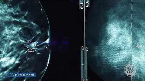 GE Healthcare | Integrating AI into the Radiologist Workflow (30s)