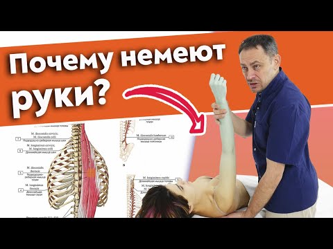 Что Делать, Если Немеет Рука 3 Главных Причины Онемения Рук