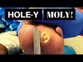 Hole-y Moly!!