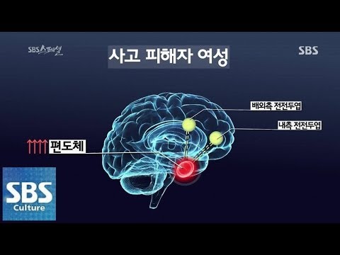 피해자들의 트라우마와 고통 @SBS 스페셜 140601