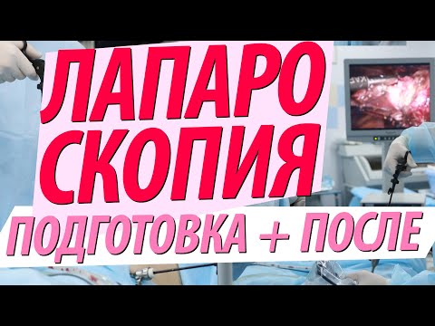 Видео: Лапароскопия: Цел, подготовка, процедура и възстановяване