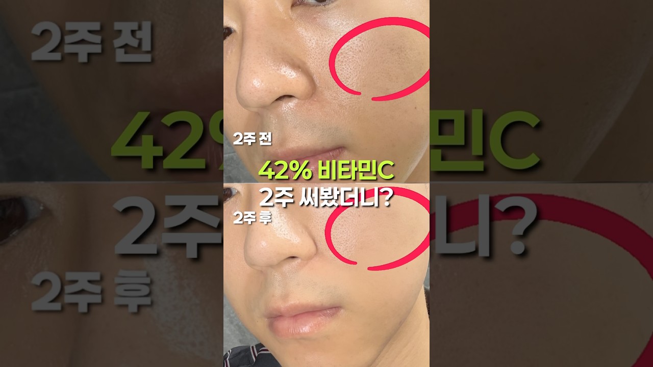 고함량 42% 비타민C 비타밤 | 직접 써봤습니다 #피부미백 #비타민c #스킨케어추천