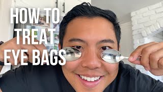 How To Get Rid Of Under Eye Bags Fast The Safest Ways Ophthalmologist 