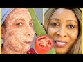 NO  JOKE USE ALOE AND TOMATO, WATCH YOUR FACE AND NECK TRANSFORM, LIVE DEMO | Khichi Beauty