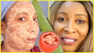 NO  JOKE USE ALOE AND TOMATO, WATCH YOUR FACE AND NECK TRANSFORM, LIVE DEMO | Khichi Beauty