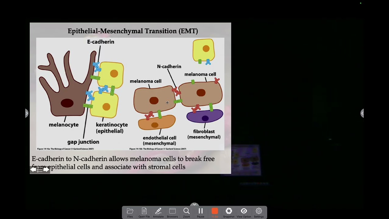 The Metastatic Cascade and Epithelial-Mesenchymal Transition
