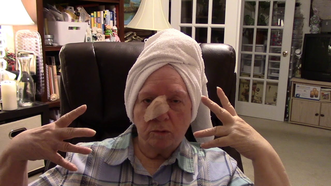 Questions Answered | Skin Cancer Surgery | Health Issues - YouTube