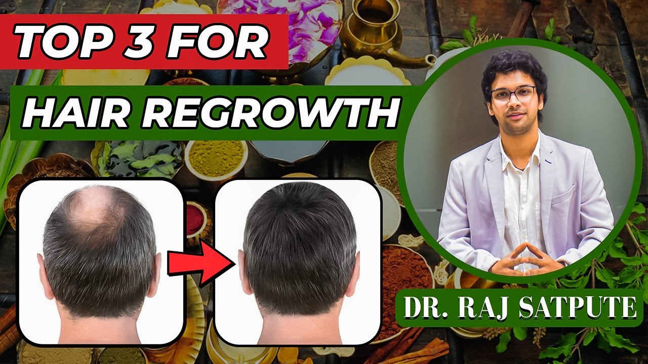 Top 3 Treatments For Hair Regrowth Best Hair Regrowth Treatment YouTube