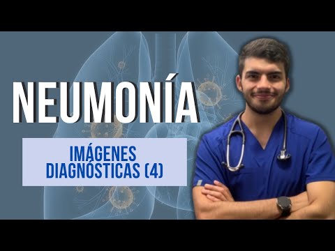 Video: ¿Qué es el neumatocele pulmonar?