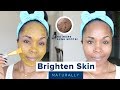 How to Brighten Skin, Reduce Acne Scars, Hyperpigmentation & Discoloration | Home Remedies