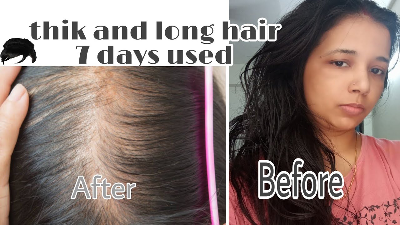 Diy Flaxseed Gel Flax Seeds For Hair Growth Hair Growth In 7 Days 😱