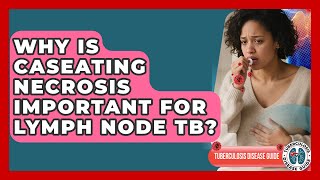 Why Is Caseating Necrosis Important For Lymph Node TB? - Tuberculosis Disease Guide screenshot 5