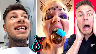 Dental TikToks That Are Painful To Watch