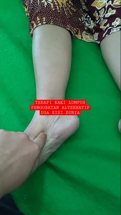 PENGOBATAN KAKI LUMPUH SEBELAH