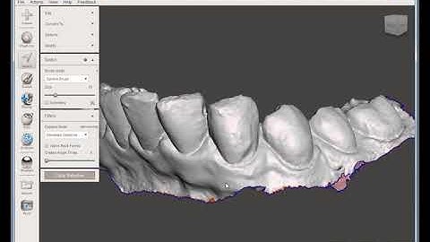 Preparing Digital Dental Models in Meshmixer