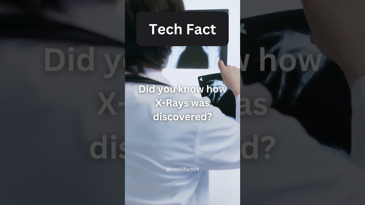 Watch X-Rays Discovery😳🤯Like and subscribe! #shorts #xrays #röntgen #medical #fracture #techfacts #tech on YouTube Watch X-Rays Discovery😳🤯Like and subscribe! #shorts #xrays #röntgen #medical #fracture #techfacts #tech on YouTube