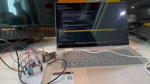 Iot based patient health monitoring system using esp 32