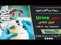 قراءة تحليل البول الكامل بالتفصيل بشرح بسيط  
