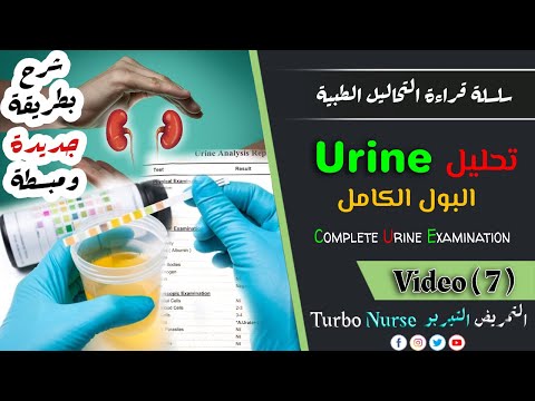 قراءة تحليل البول الكامل بالتفصيل بشرح بسيط  