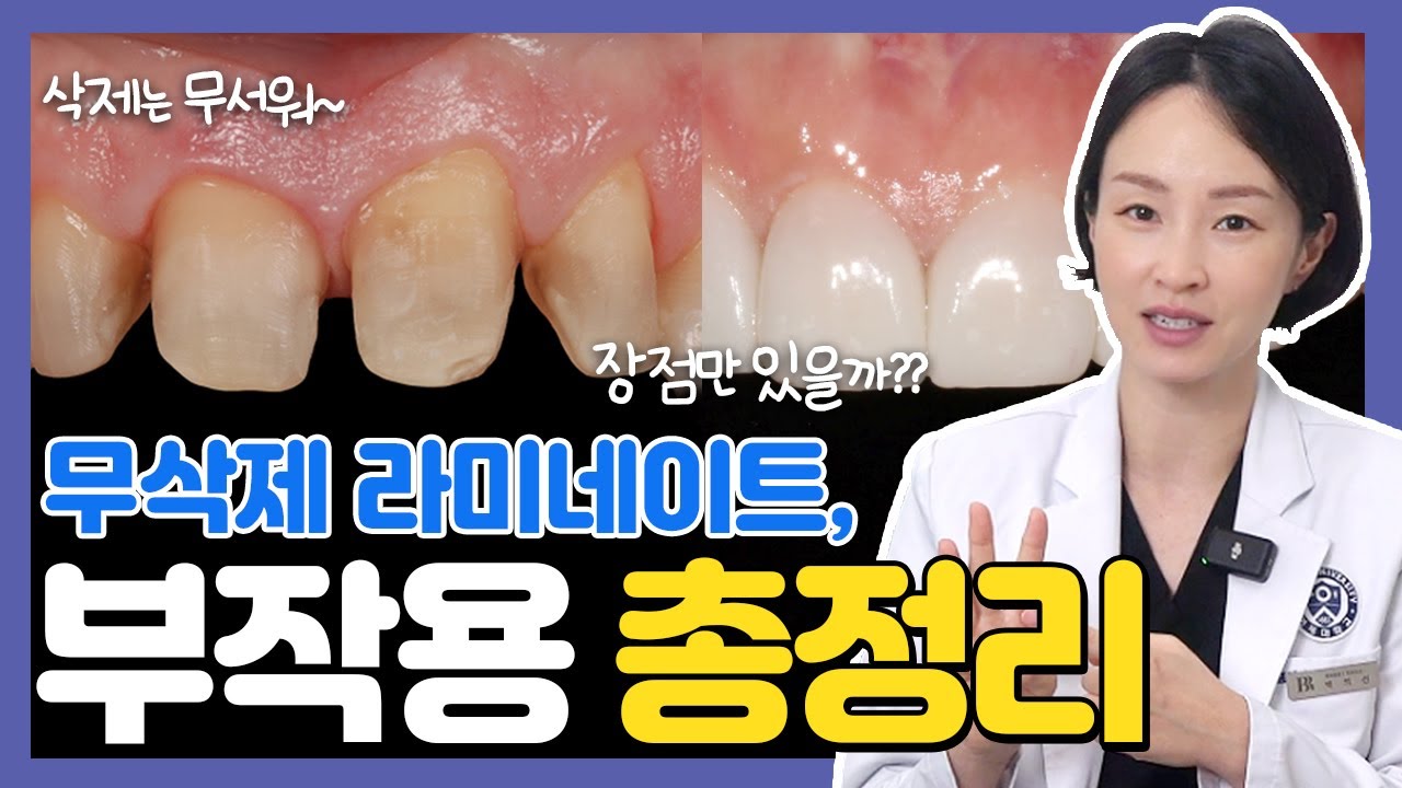 ()만족도 최상 무삭제 라이네이트, 부작용도 꼭 알아두세요. 🚨