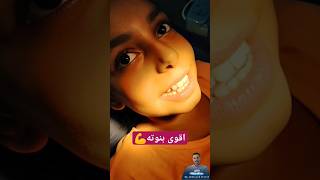 اشطر منه في الدنيا||ما شاء الله ||خلع ناب لبني سفليdr_abdullah_sultan_dentist