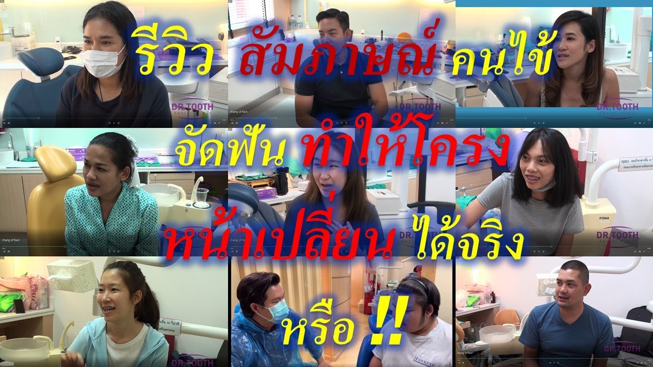 จัดฟันทำให้หน้าเปลี่ยนจริงไหม ? รีวิวแชร์ประสบการณ์จัดฟัน จากประสบการณ์จริง #จัดฟันที่ไหนดี #จัดฟัน 