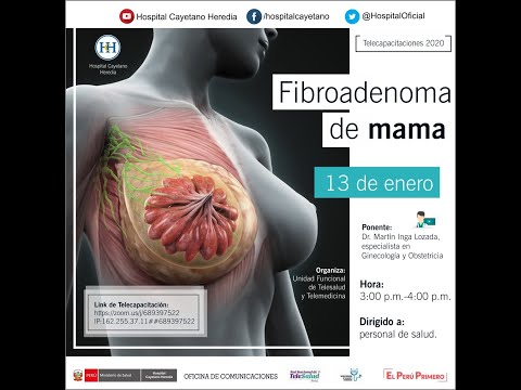 Video: Cómo tratar el fibroadenoma de mama y qué es