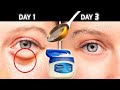 In just 3 min it removes wrinkles and bags under eyes  completely dark circle puffy eyes