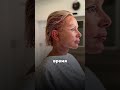 ЛИЦО ПОМОЛОДЕЕТ СЛИШКОМ СИЛЬНО ОТ ЭТОГО  БУДЬТЕ ОСТОРОЖНЫ С ЭТОЙ МАСКОЙ ОТ МОРЩИН