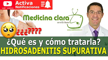 ¿Puede desaparecer la hidradenitis supurativa?