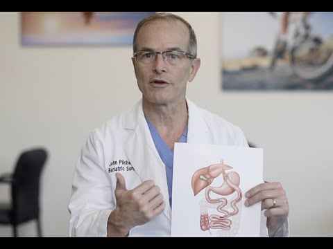 How the Gastric Bypass Works - YouTube