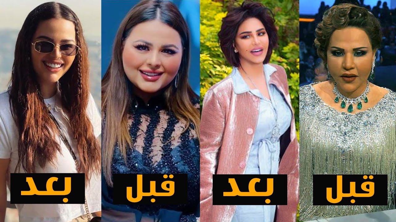8 فنانين تحولو بعد فقدان وزنهم -2021