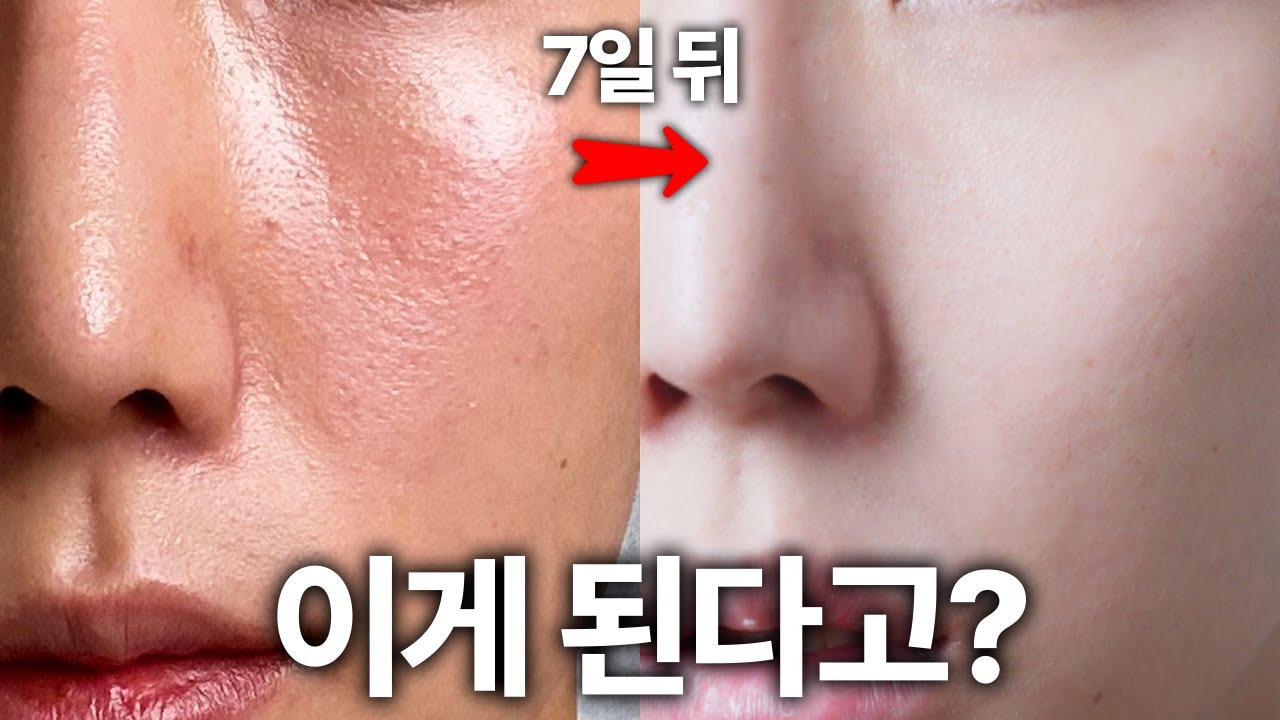 따라하면 일주일만에 피부 좋아지는 클렌징/스킨케어/식습관 루틴