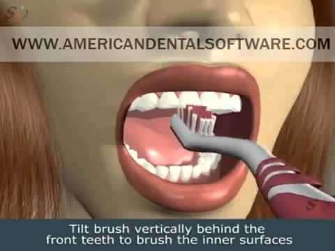 American Dental Software - Brushing in 3D video