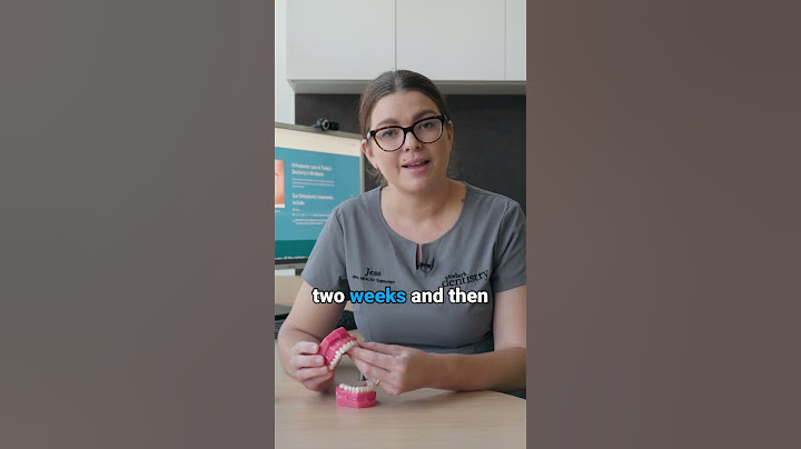 How do clear aligners work?