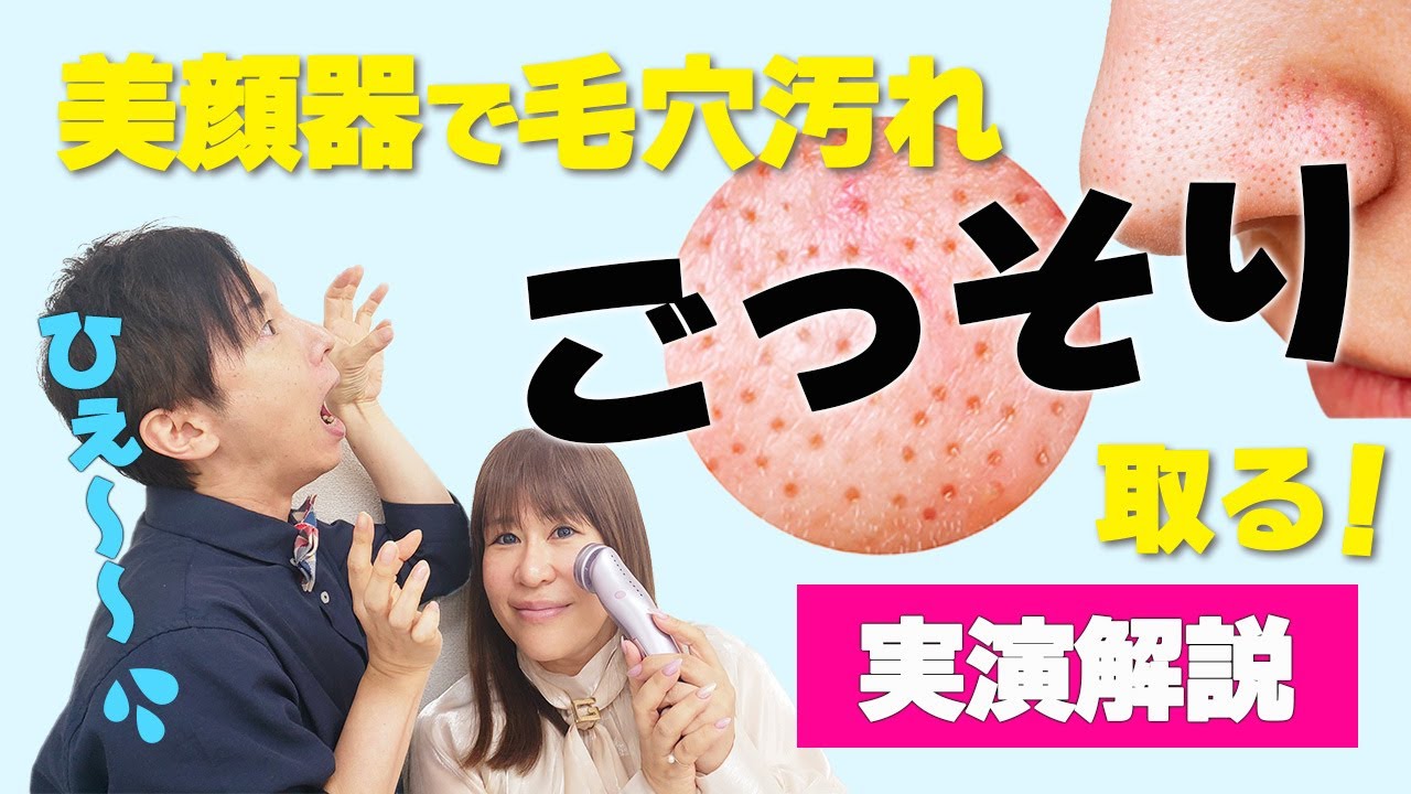 美顔器で毛穴汚れをごっそり取る方法 【自宅でできる毛穴をなくす方法を実演】 - YouTube