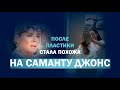 Пластика верхней трети лица: подтяжка лба и висков + блефаропластика