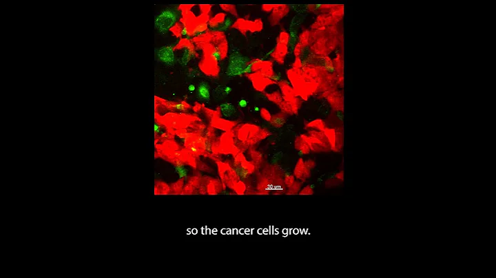 Immune cells versus metastatic tumor cells - DayDayNews