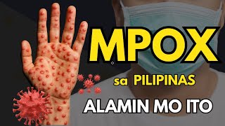 Mpox (Monkeypox) sa Pilipinas | Mga Dapat na Alamin