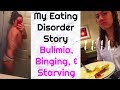 My Eating Disorder Story (photos included) | Bulimia was eating me alive..
