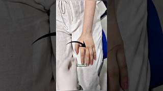 Life Changing Silicone Fingers Prosthetics..