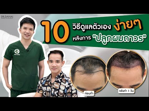 วีดีโอ: วิธีการปลูกผมใหม่: 10 ขั้นตอน (พร้อมรูปภาพ)