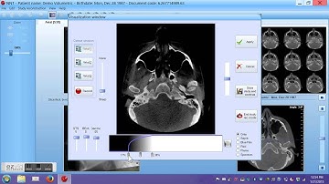 NNT Software Tutorial #1