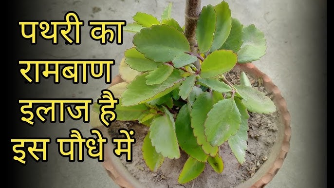 7 से 15 दिन मे पूरी पथरी खत्म कर देगा पथरी का ऐसा आयुर्वेदिक घरेलू इलाज “ > ˌ 7 से 15 दिन मे पूरी पथरी खत्म कर देगा पथरी का ऐसा आयुर्वेदिक घरेलू इलाज “ > ˌ