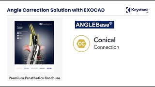 Keystone Conical Connection: ANGLEBase®