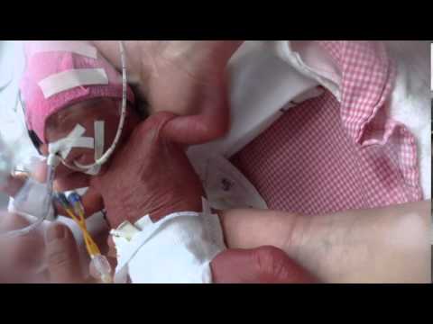 Video: Premature Overlevingspercentages Voor Baby's