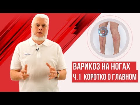 Варикозное расширение вен нижних конечностей 1 видео