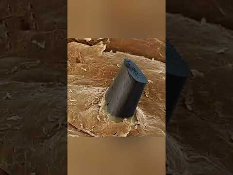 شعرة ذقن مقطوعة بالموس بعد يوم من الحلاقة