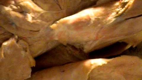 Cat Dissection: Deep Chest Muscles